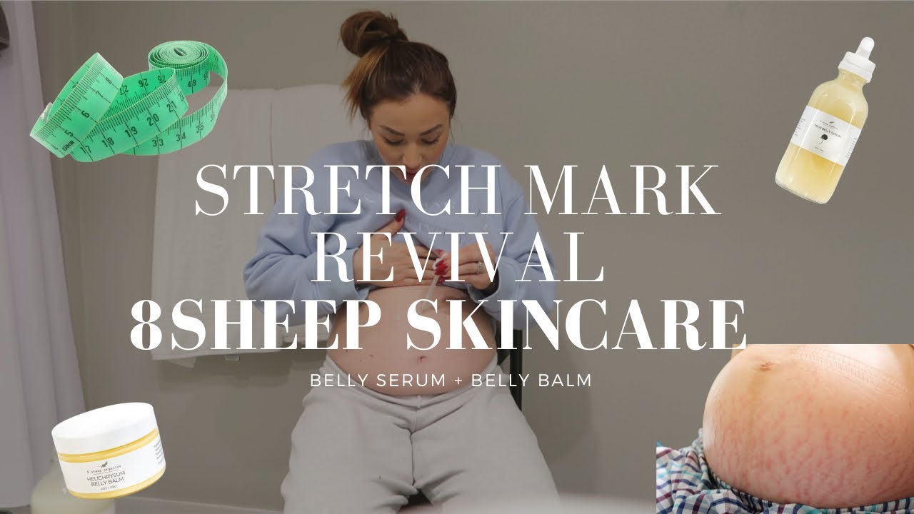 How To Manage Stretch Marks During Pregnancy - 8 SHEEP ORGANICS