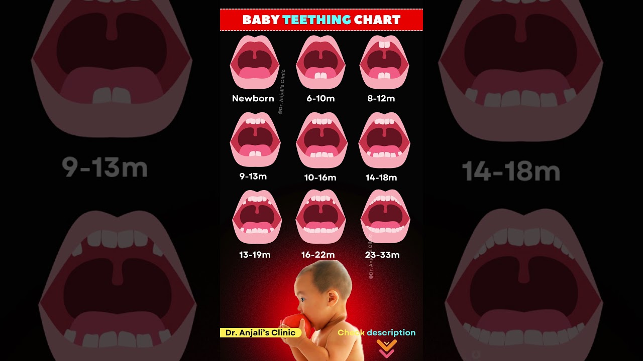 Baby Teeth Eruption Chart: Timeline & Order of Baby Teeth Growth | Baby tooth development