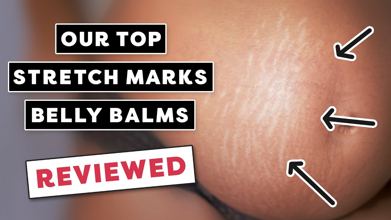 Top 5 Belly Balms for Pregnancy Stretch Marks & Itching | Tried & Tested